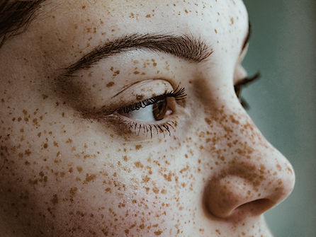 Cosmetic Laser